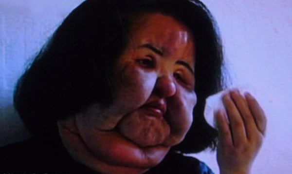 plastic-surgery-5